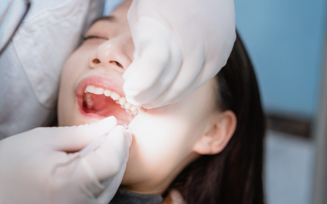ekstrakcja zęba trzonowego