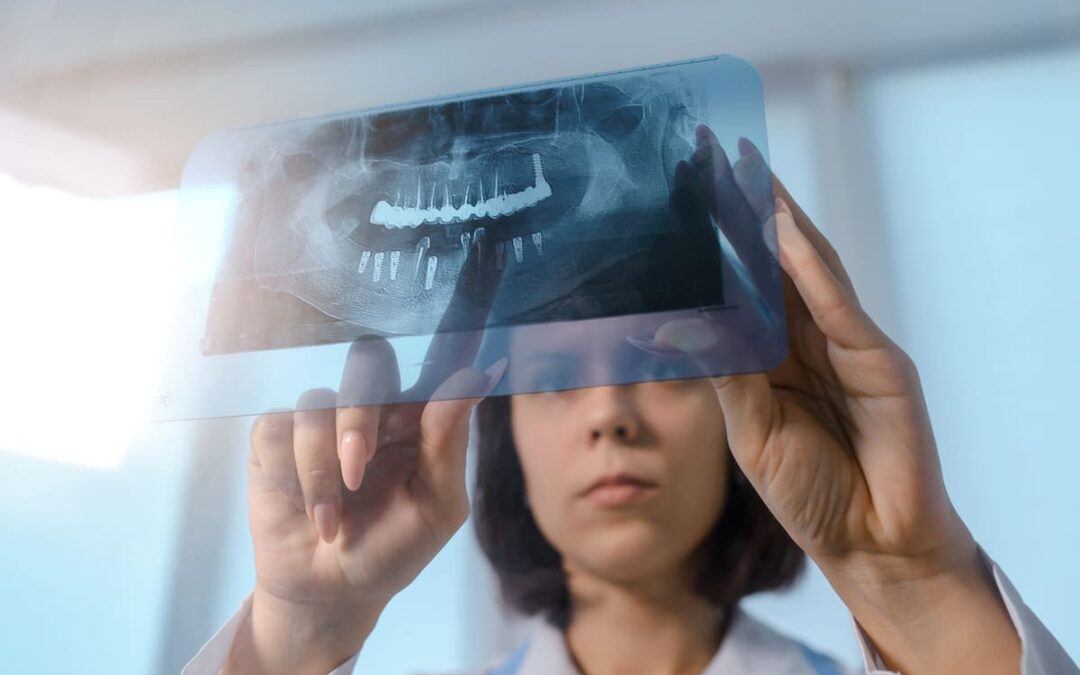 Tomografia zęba – co pokazuje i po co ją wykonać?