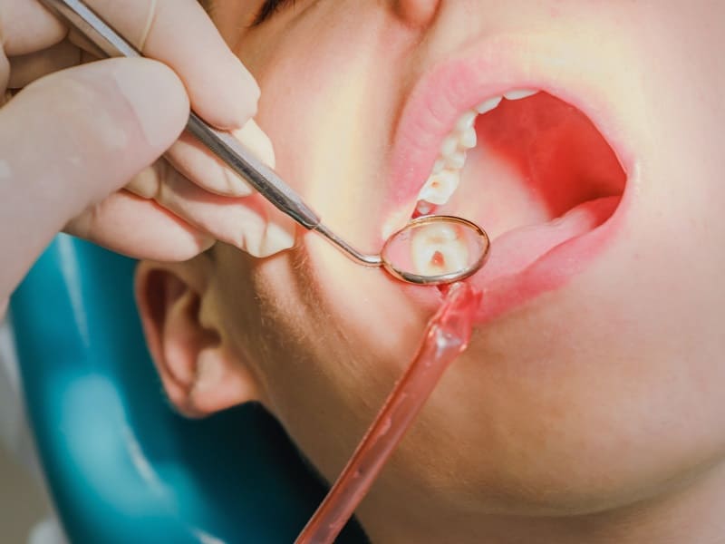 Zastosowanie tytanu w implantologii stomatologicznej