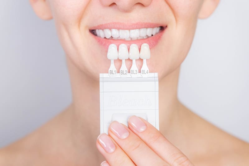 Śnieżnobiały uśmiech? Jak odpowiednio dobrać kolor koron implantów zębowych?
