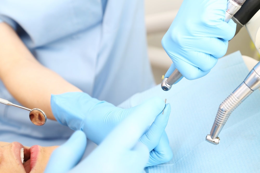 Czy leczenie kanałowe naprawdę musi boleć? Fakty i mity o nowoczesnej endodoncji